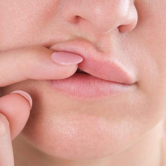 The Science Behind Dermal Filler Migration: Prevention and Solutions