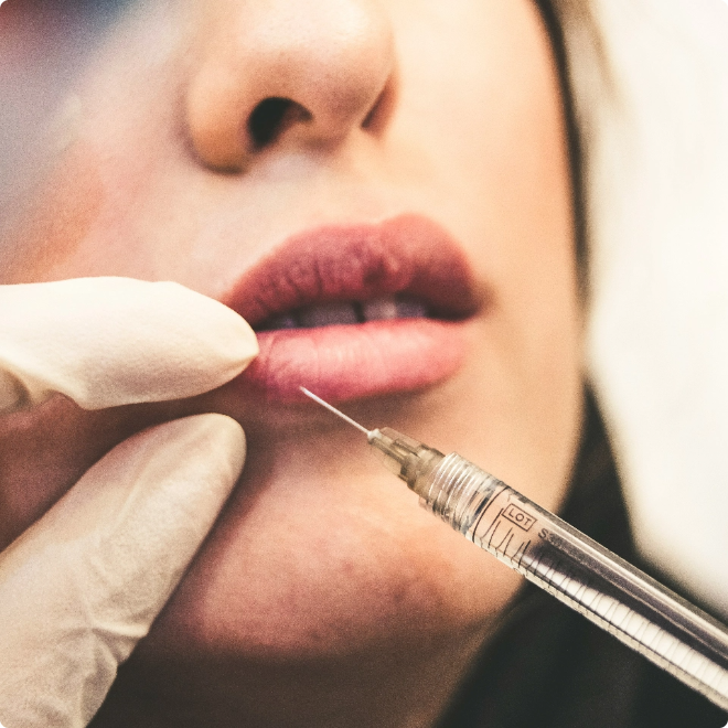 Dermal Fillers